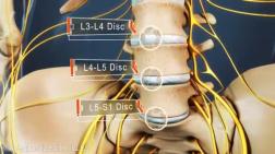 lumbar-spine-L3-L4-L5-S1